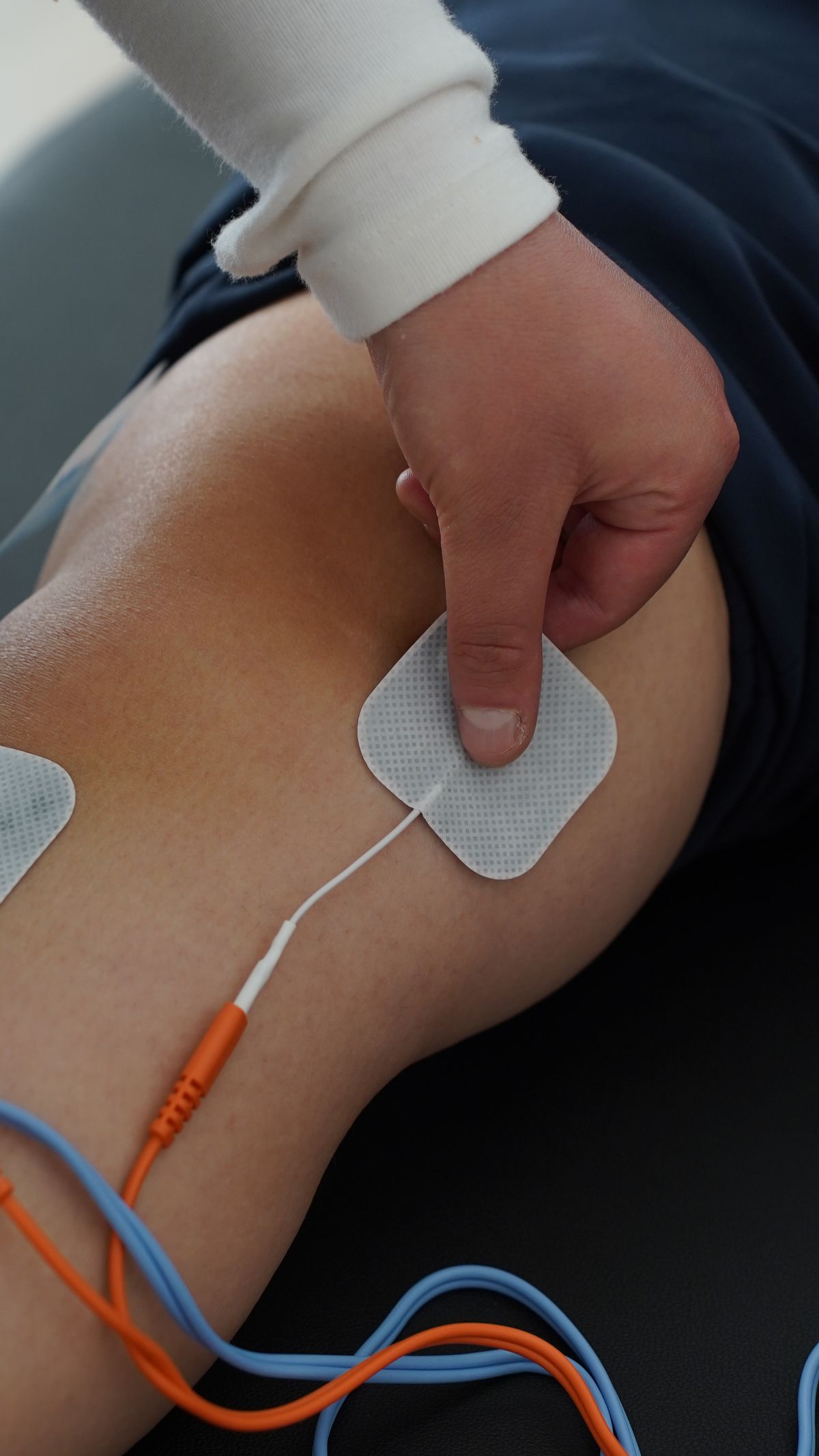 Illustrative image representing FES Treatment